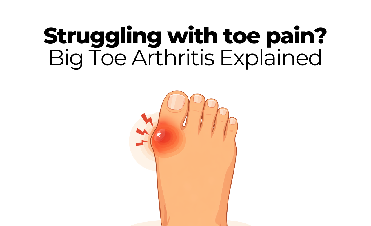 Big Toe Arthritis Explained – The Rehab Mechanics US