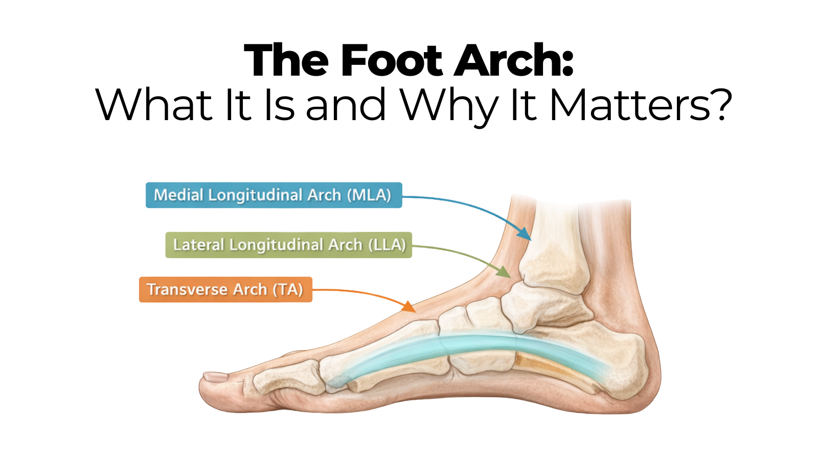 Foot Arch Explained – The Rehab Mechanics US